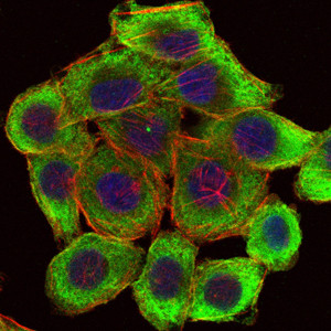Anti-LIMS1