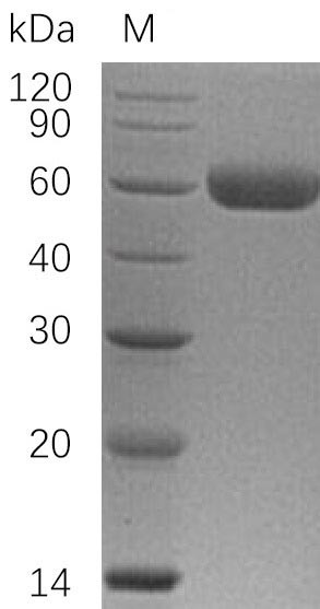 Tumor necrosis factor receptor superfamily member 10C (TNFRSF10C), partial (Active), human, recombin