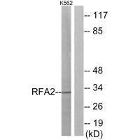 Anti-RPA2 (Ab-21)