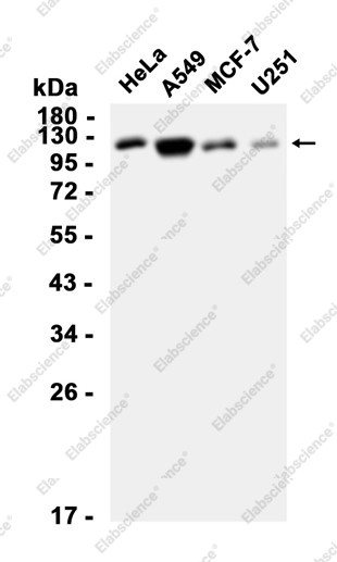 Anti-Recombinant BUBR1, clone C372685