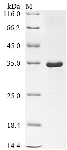 T7 T7 RNA polymerase (1), partial, Enterobacteria phage, recombinant