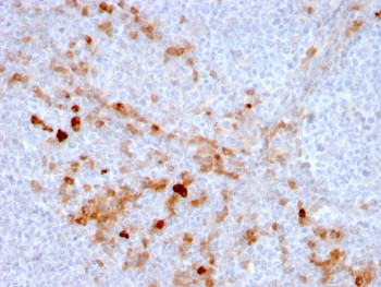 Anti-CD105 / Endoglin, clone ENG/3269