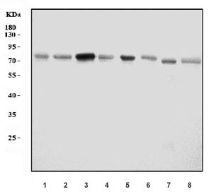 Anti-Acid Phosphatase / ACP2 (Lysosomal)