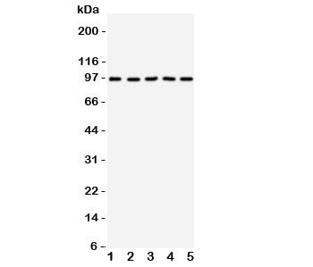 Anti-TrkC