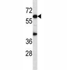Anti-Akt1