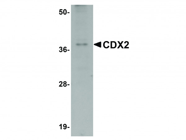 Anti-CDX2