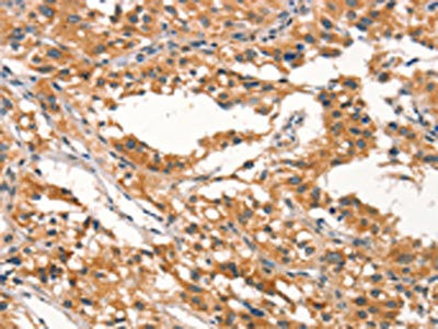 Anti-RHOBTB2