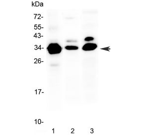 Anti-IL1 beta