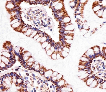 Anti-ATP5B