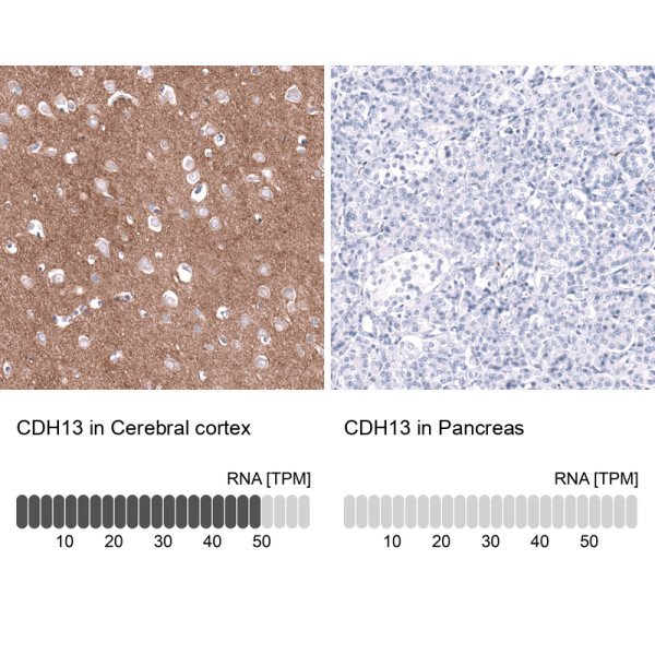Anti-ABCB5, clone CL15368