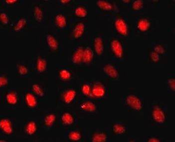 Anti-STK11 / LKB1