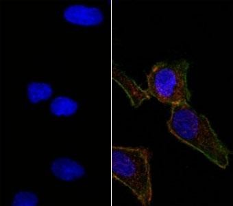 Anti-EpCAM, clone EGP40/826