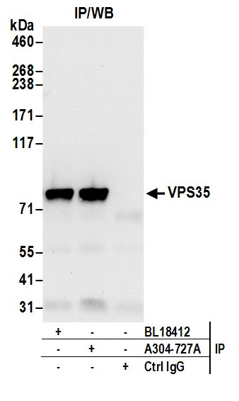 Anti-VPS35