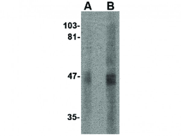 Anti-SIRT2
