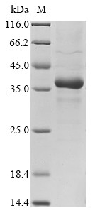 Ficolin-2 (FCN2), human, recombinant