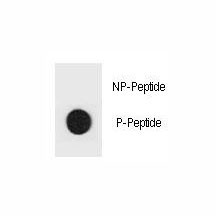 Anti-phospho-TSC1 (Tyr312)