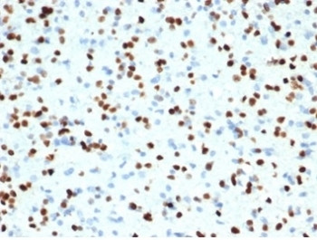 Anti-OLIG2, clone OLIG2/7074R
