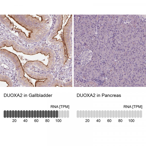 Anti-DUOXA2