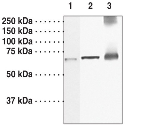 Anti-Guanylate Cyclase beta1