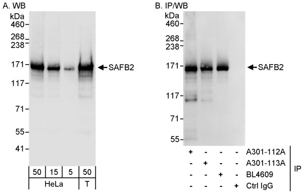 Anti-SAFB2