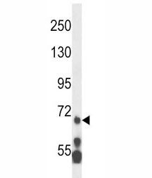 Anti-MLL5