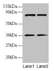 Anti-HNRNPH1