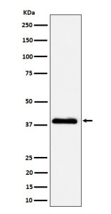 Anti-NSDHL / NADP dependent steroid dehydrogenase like protein, clone 30N01