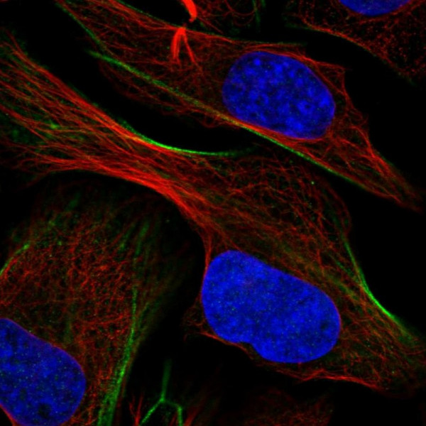 Anti-ATP6V1H