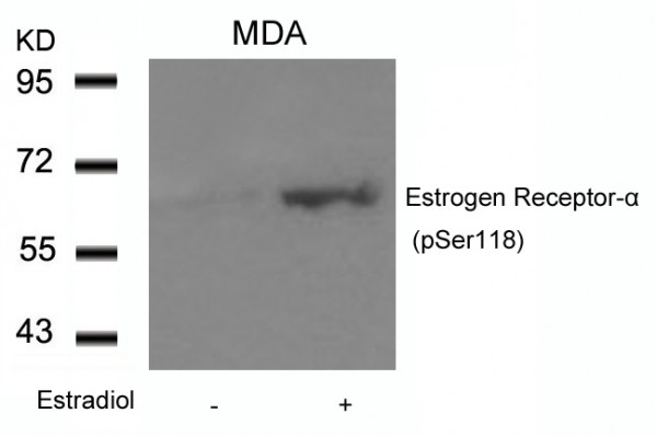 Anti-phospho-Estrogen Receptor alpha (Ser118)