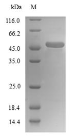 Tubulin beta-4A chain (TUBB4A), human, recombinant