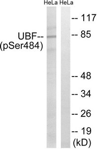 Anti-Phospho-UBTF (Ser484)