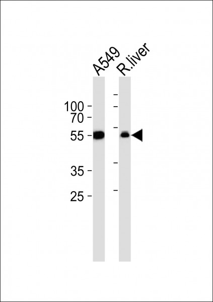 Anti-ALDH1A1
