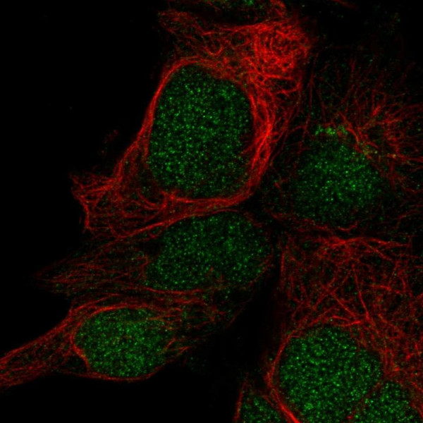 Anti-LYSMD1