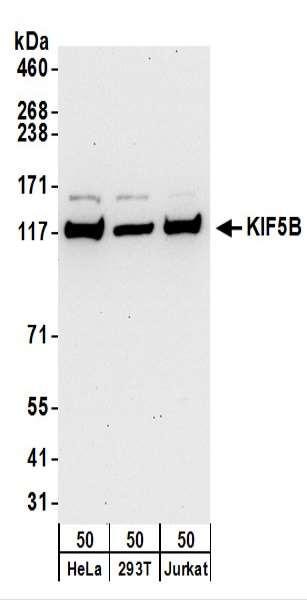 Anti-KIF5B