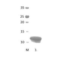 LNX2_2 PDZ Domain