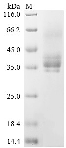Methyl-CpG-binding domain protein 2 (MBD2), partial, human, recombinant