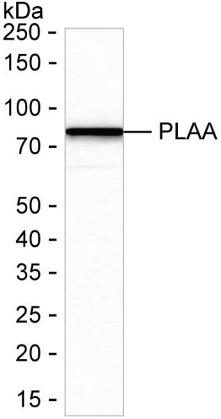 Anti-Phospholipase A2 Activator Protein