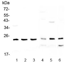 Anti-RAB6A