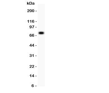 Anti-5-Lipoxygenase