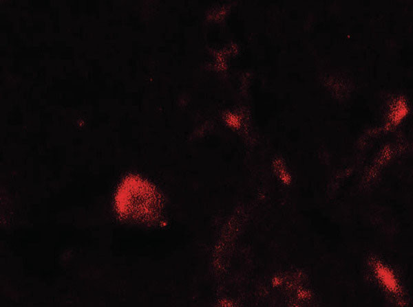 Anti-TET1