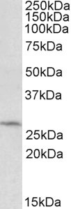 Anti-DCUN1D1, C-terminal