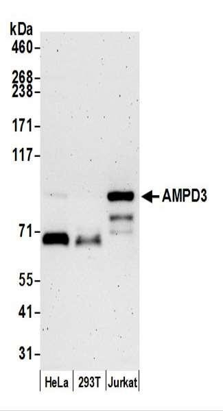 Anti-AMPD3