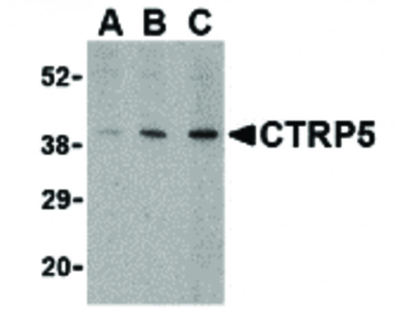 Anti-CTRP5