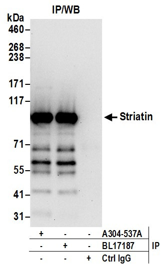Anti-Striatin
