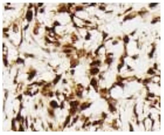 Anti-phospho-MLKL (Ser358)