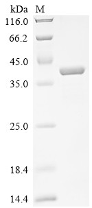 Endoplasmic reticulum metallopeptidase 1 (ERMP1), partial, human, recombinant