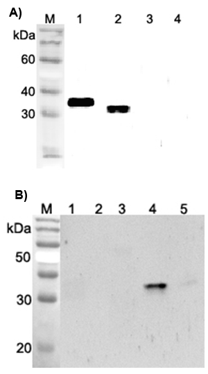 Anti-ANGPTL4 (fibrinogen-like domain) (human)