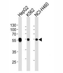 Anti-ALDH1A1 / Acetaldehyde dehydrogenase 1, clone 152CT1.2.2