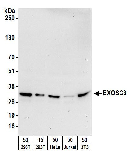 Anti-EXOSC3