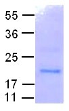 Rab11 (Rab-protein 11, CG5771, DmRab11, Drab11, Rab-r11, RAB11), human, recombinant full length, His